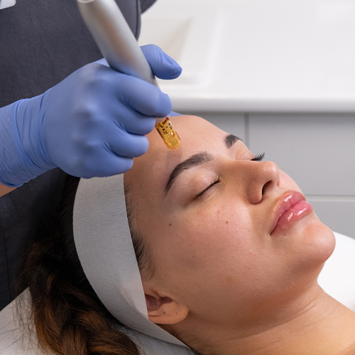 Skin Needling + Mesotherapy (Full Face) x 4 Package | Brisbane Skin & Laser Clinics