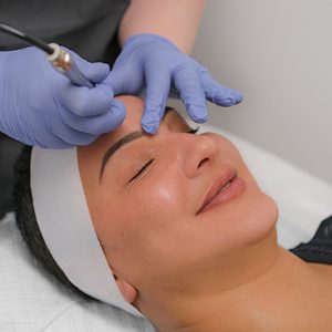 Signature Microdermabrasion